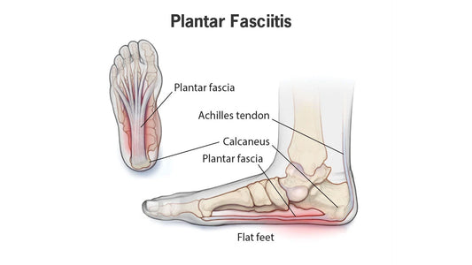 From Pain to Gain: How Vibrating Rollers Can Help Plantar Fasciitis